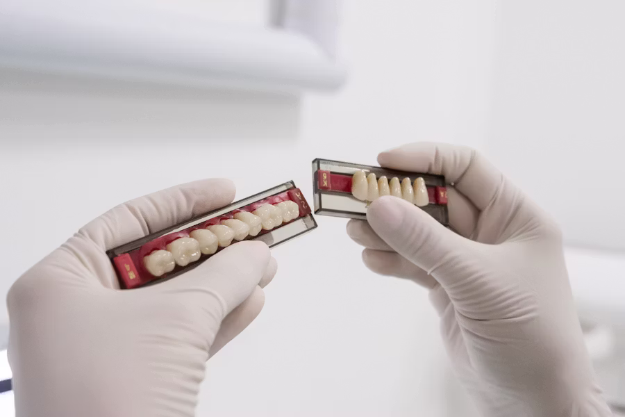 Cura dell'impianto dentale — Studio Dentistico Dr. Paolo Casadei