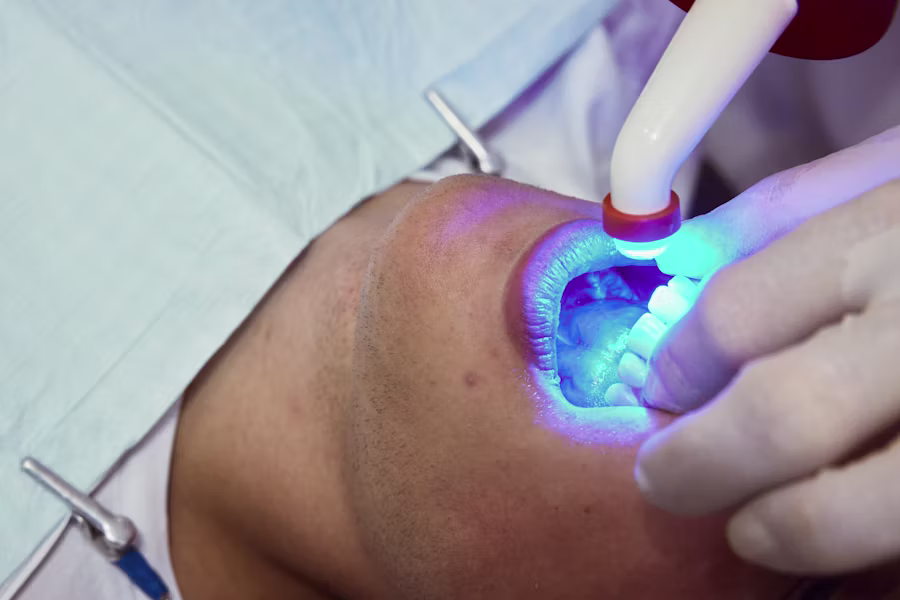 Sbiancamento denti professionale in studio — Studio Dentistico Dr. Paolo Casadei