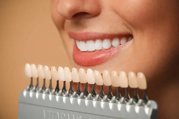 Sorriso perfetto con trattamenti di estetica dentale — Studio Dentistico Dr. Paolo Casadei